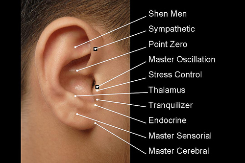 Master Tung Acupuncture and Herbs Alleviate Tinnitus